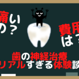 【恐怖】歯の神経治療！痛いの？高いの？何されるの！？